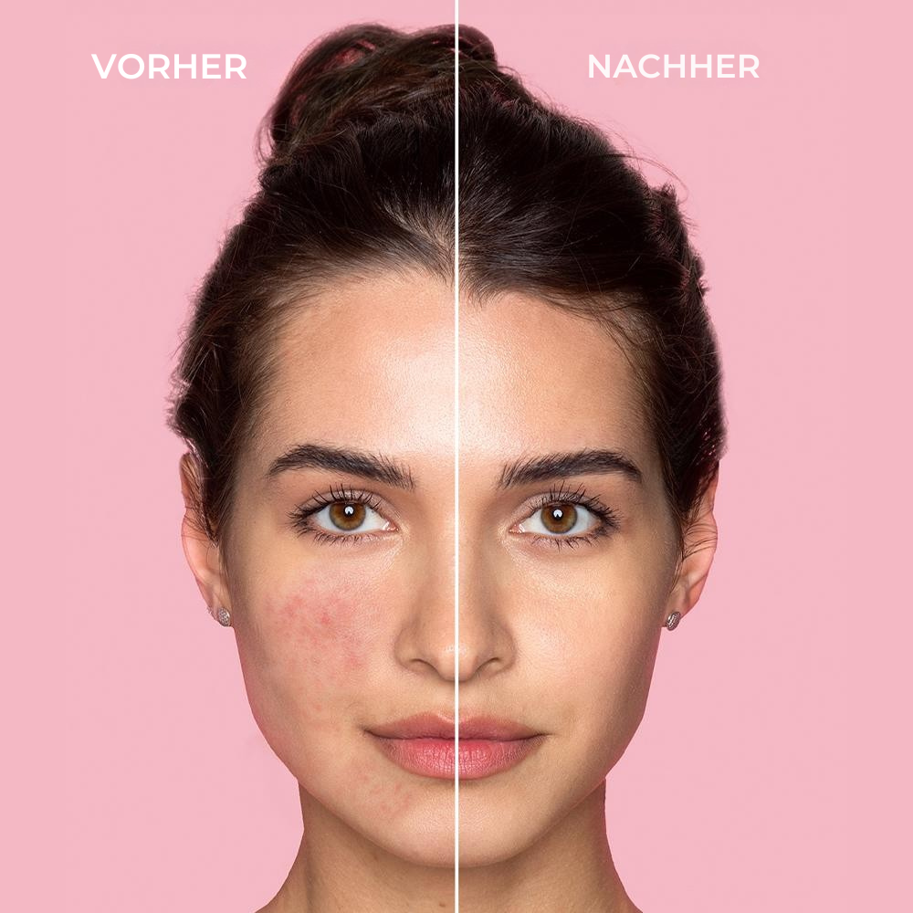 Sinoz Pure Cica Tigergrass 15ml