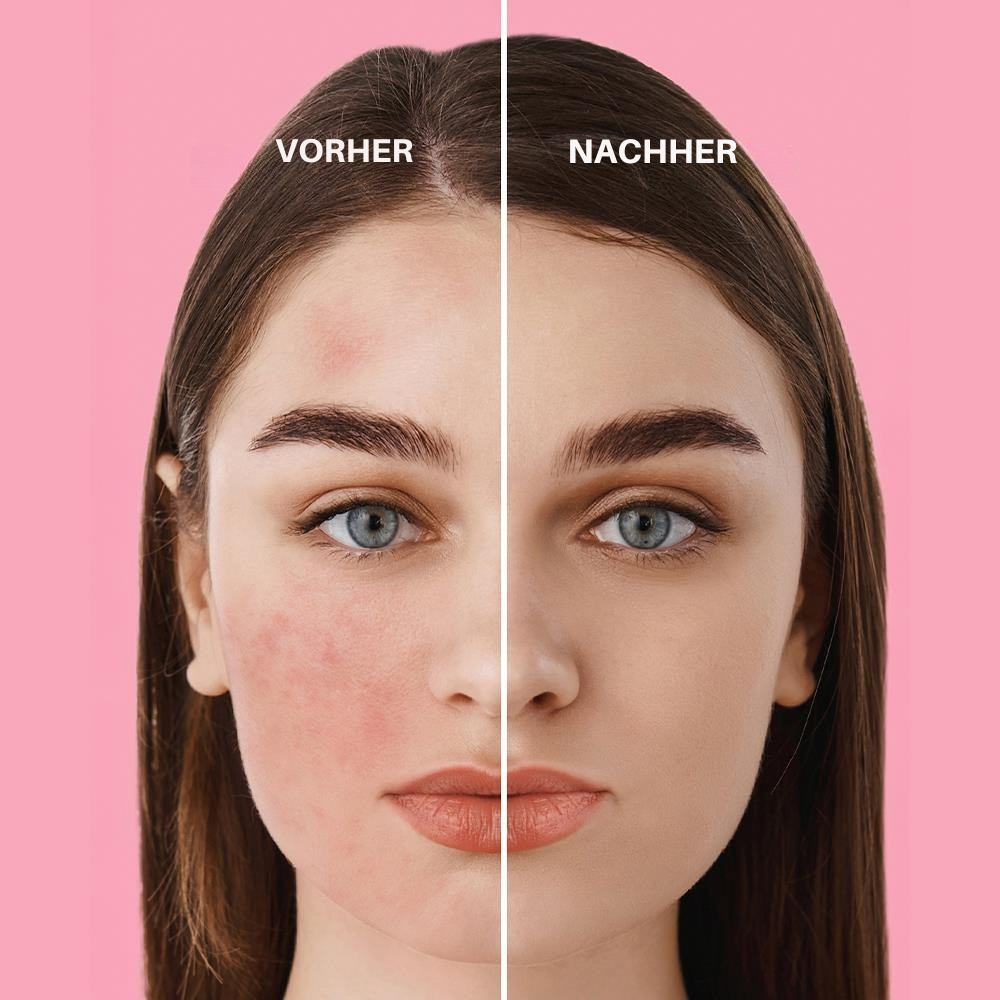 Sinoz Pink Touch getönte Flüssigsonnencreme SPF50 – Speziell für helle Hauttypen